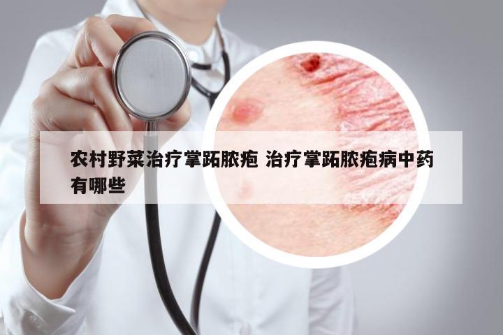 農(nóng)村野菜治療掌跖膿皰 治療掌跖膿皰病中藥有哪些