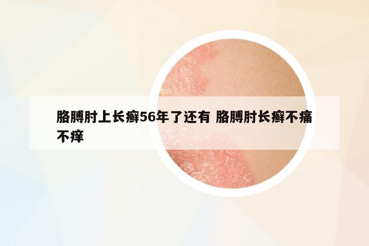 胳膊肘上長(zhǎng)癬56年了還有 胳膊肘長(zhǎng)癬不痛不癢