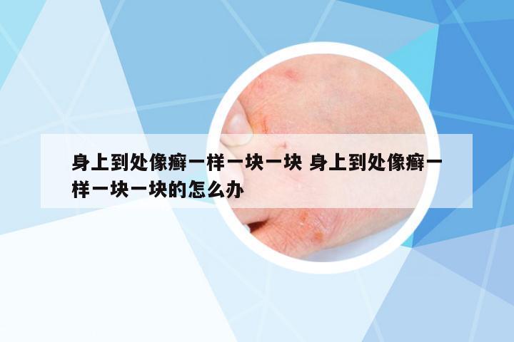 身上到處像癬一樣一塊一塊 身上到處像癬一樣一塊一塊的怎么辦