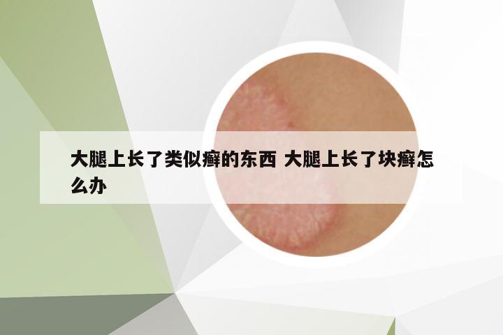 大腿上長了類似癬的東西 大腿上長了塊癬怎么辦