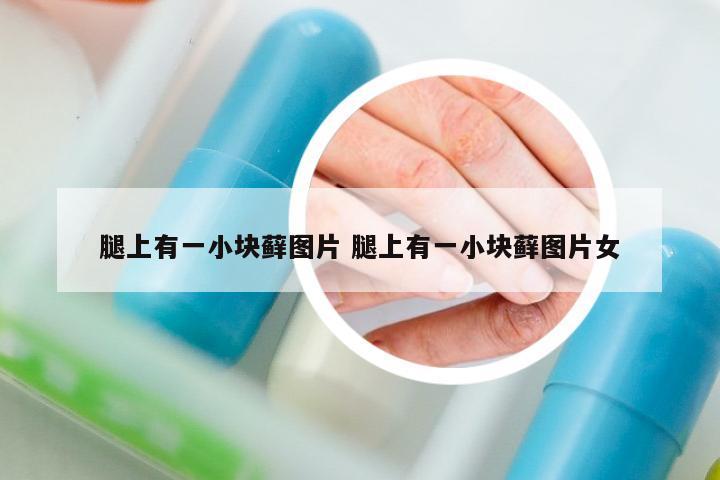 腿上有一小塊蘚圖片 腿上有一小塊蘚圖片女