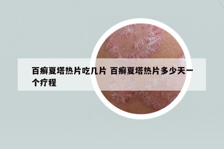 百癬夏塔熱片吃幾片 百癬夏塔熱片多少天一個(gè)療程