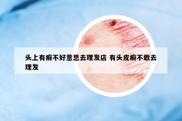 頭上有癬不好意思去理發(fā)店 有頭皮癬不敢去理發(fā)