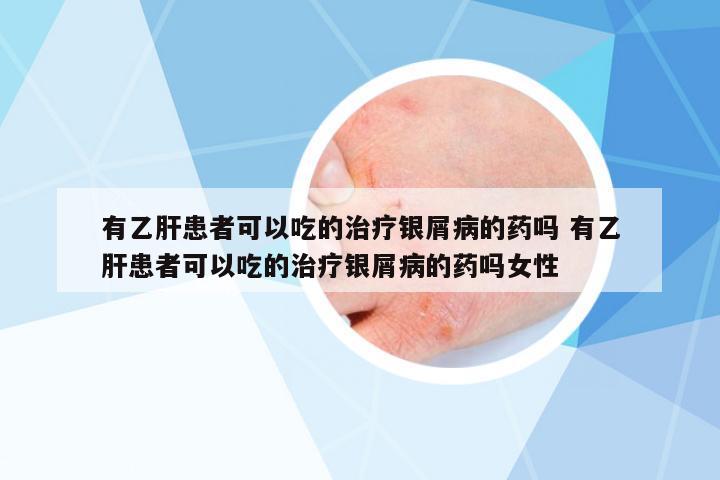 有乙肝患者可以吃的治療銀屑病的藥嗎 有乙肝患者可以吃的治療銀屑病的藥嗎女性