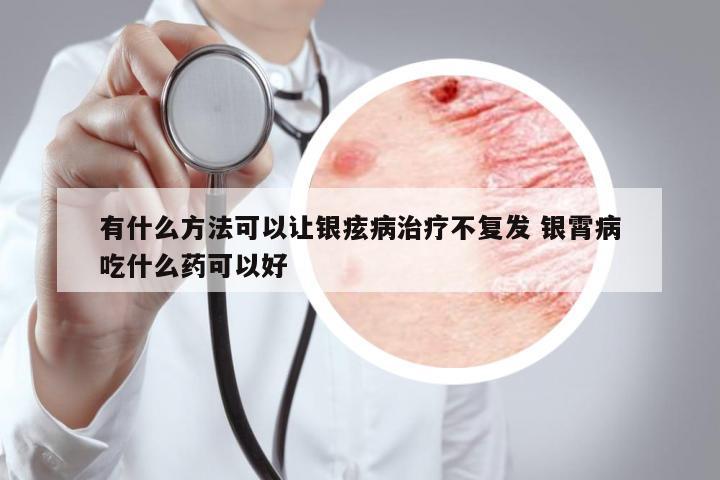 有什么方法可以讓銀痃病治療不復(fù)發(fā) 銀霄病吃什么藥可以好