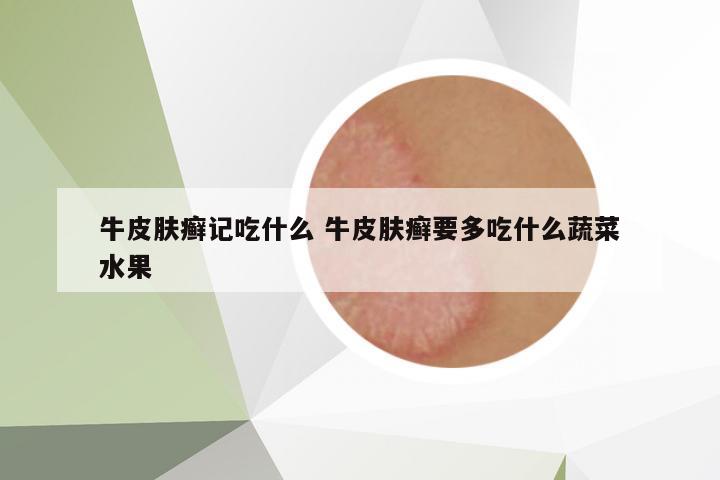 牛皮膚癬記吃什么 牛皮膚癬要多吃什么蔬菜水果