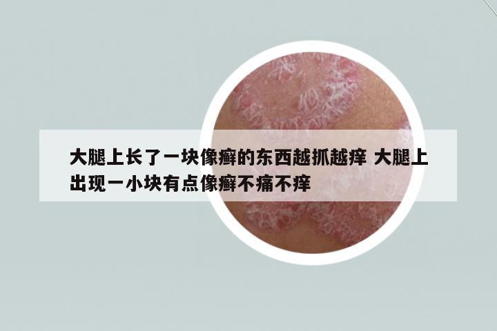 大腿上長了一塊像癬的東西越抓越癢 大腿上出現(xiàn)一小塊有點像癬不痛不癢