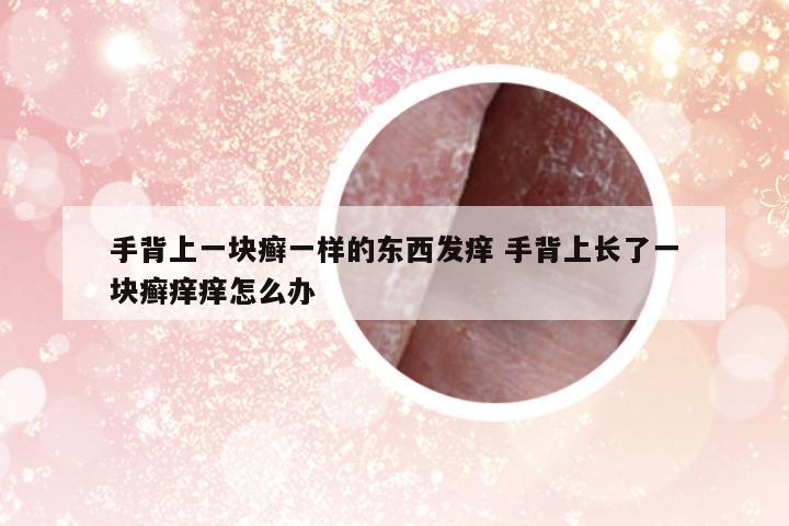 手背上一塊癬一樣的東西發(fā)癢 手背上長(zhǎng)了一塊癬癢癢怎么辦