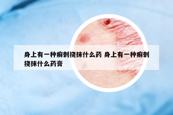身上有一種癬刺撓抹什么藥 身上有一種癬刺撓抹什么藥膏