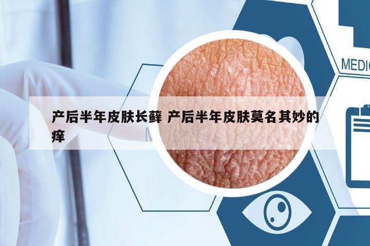 產(chǎn)后半年皮膚長蘚 產(chǎn)后半年皮膚莫名其妙的癢