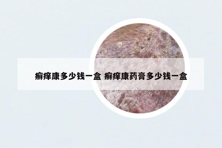 癬癢康多少錢一盒 癬癢康藥膏多少錢一盒