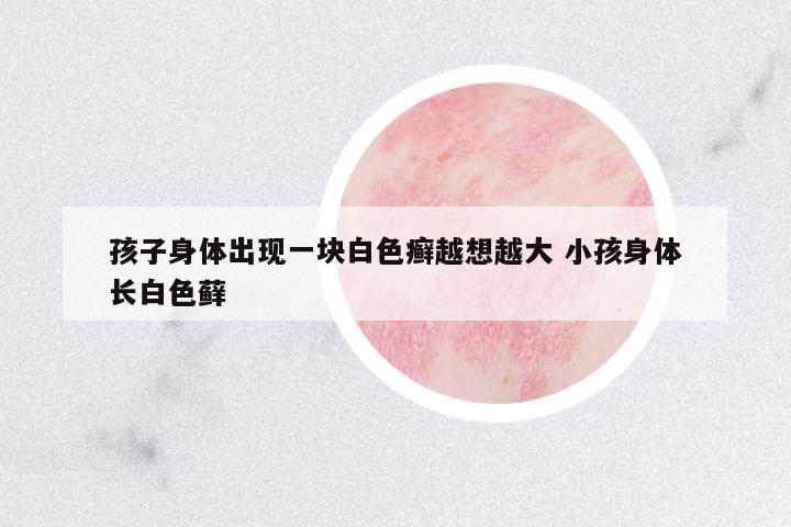 孩子身體出現(xiàn)一塊白色癬越想越大 小孩身體長白色蘚