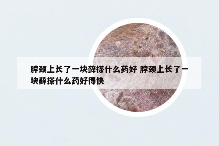 脖頸上長了一塊蘚搽什么藥好 脖頸上長了一塊蘚搽什么藥好得快