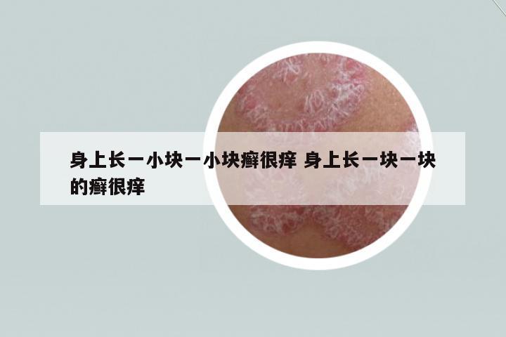身上長一小塊一小塊癬很癢 身上長一塊一塊的癬很癢