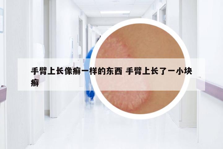 手臂上長像癬一樣的東西 手臂上長了一小塊癬