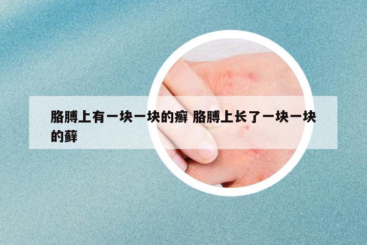 胳膊上有一塊一塊的癬 胳膊上長(zhǎng)了一塊一塊的蘚