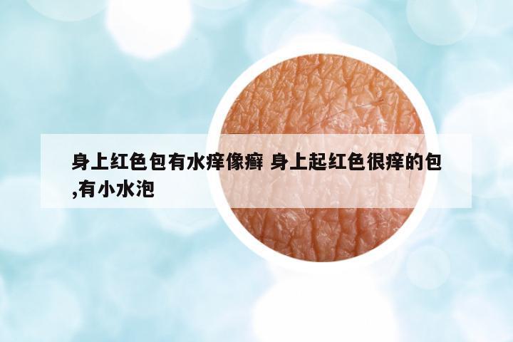 身上紅色包有水癢像癬 身上起紅色很癢的包,有小水泡