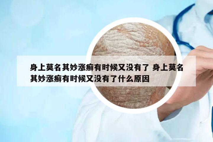 身上莫名其妙漲癬有時候又沒有了 身上莫名其妙漲癬有時候又沒有了什么原因