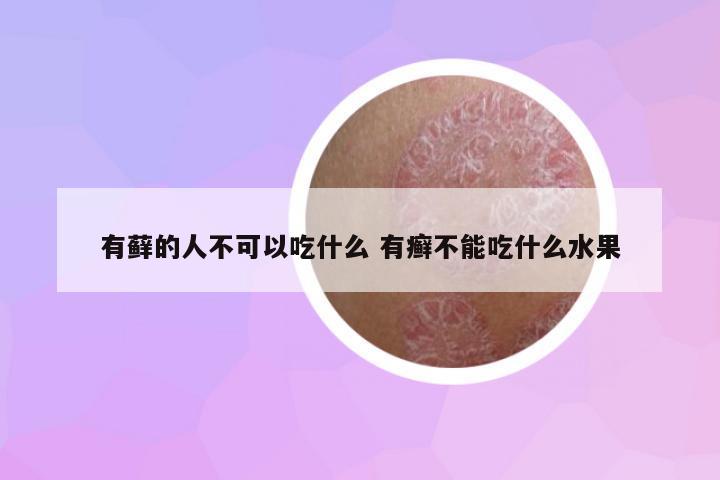 有蘚的人不可以吃什么 有癬不能吃什么水果