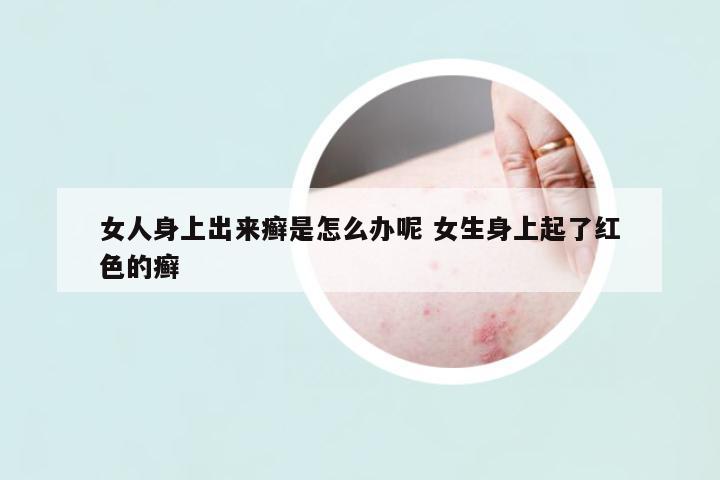 女人身上出來(lái)癬是怎么辦呢 女生身上起了紅色的癬