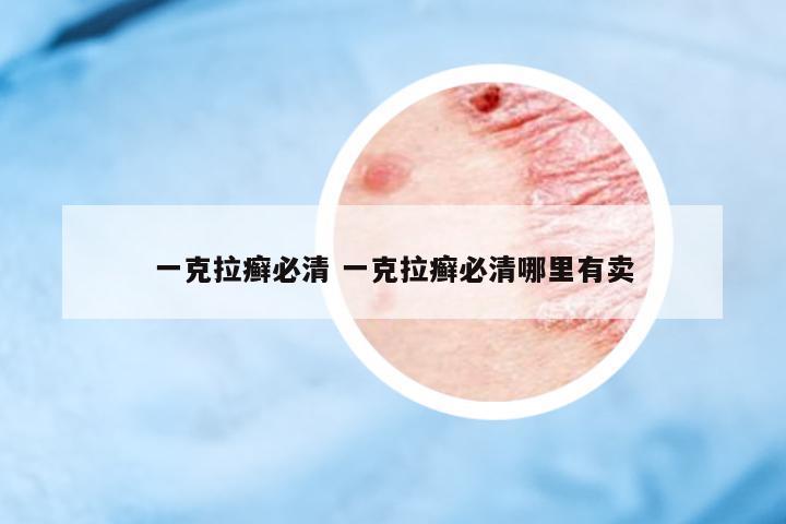 一克拉癬必清 一克拉癬必清哪里有賣