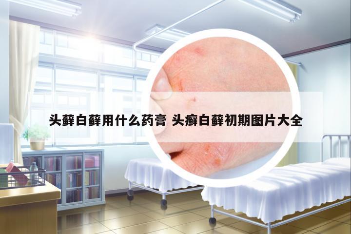 頭蘚白蘚用什么藥膏 頭癬白蘚初期圖片大全