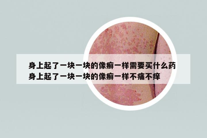 身上起了一塊一塊的像癬一樣需要買什么藥 身上起了一塊一塊的像癬一樣不痛不癢