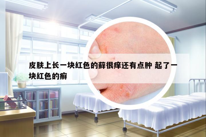 皮膚上長一塊紅色的蘚很癢還有點腫 起了一塊紅色的癬