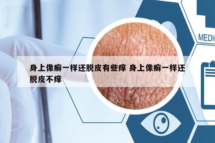 身上像癬一樣還脫皮有些癢 身上像癬一樣還脫皮不癢