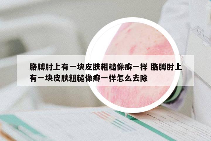 胳膊肘上有一塊皮膚粗糙像癬一樣 胳膊肘上有一塊皮膚粗糙像癬一樣怎么去除