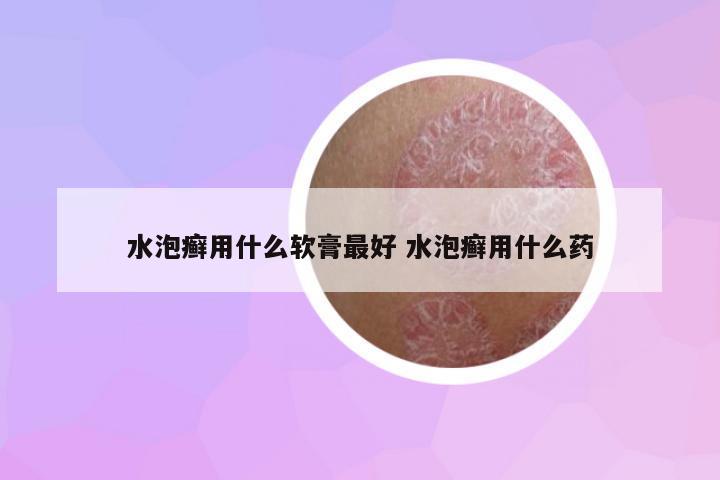 水泡癬用什么軟膏最好 水泡癬用什么藥