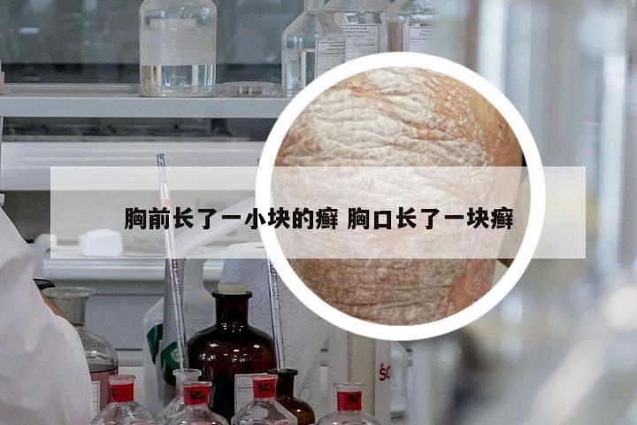 胸前長了一小塊的癬 胸口長了一塊癬