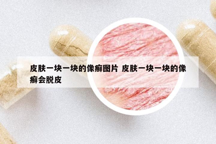 皮膚一塊一塊的像癬圖片 皮膚一塊一塊的像癬會(huì)脫皮