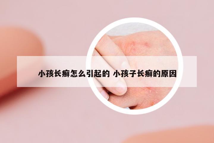 小孩長癬怎么引起的 小孩子長癬的原因