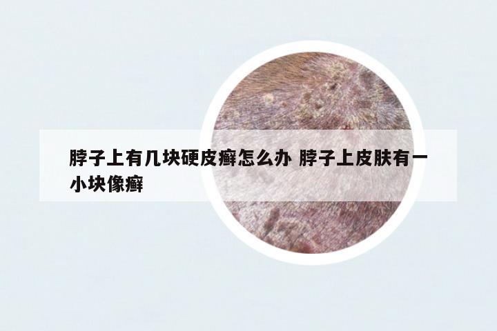脖子上有幾塊硬皮癬怎么辦 脖子上皮膚有一小塊像癬