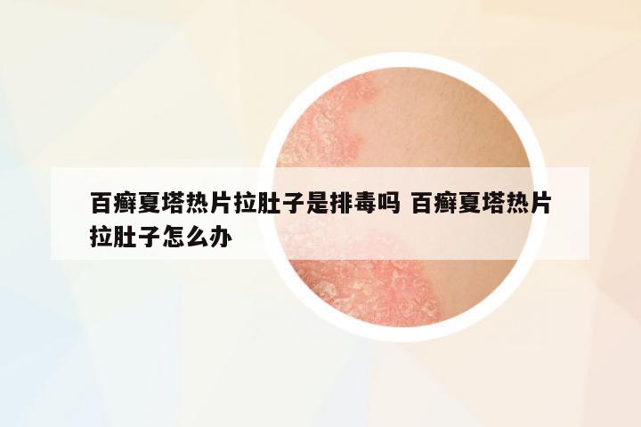 百癬夏塔熱片拉肚子是排毒嗎 百癬夏塔熱片拉肚子怎么辦