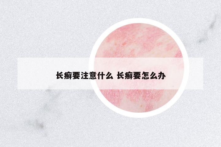 長癬要注意什么 長癬要怎么辦