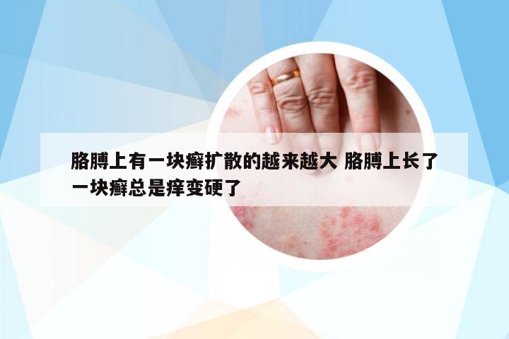 胳膊上有一塊癬擴散的越來越大 胳膊上長了一塊癬總是癢變硬了