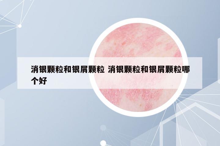 消銀顆粒和銀屑顆粒 消銀顆粒和銀屑顆粒哪個(gè)好