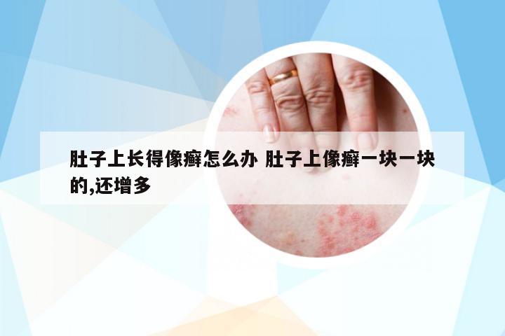 肚子上長得像癬怎么辦 肚子上像癬一塊一塊的,還增多