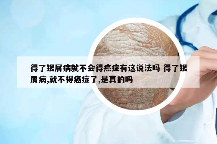 得了銀屑病就不會得癌癥有這說法嗎 得了銀屑病,就不得癌癥了,是真的嗎