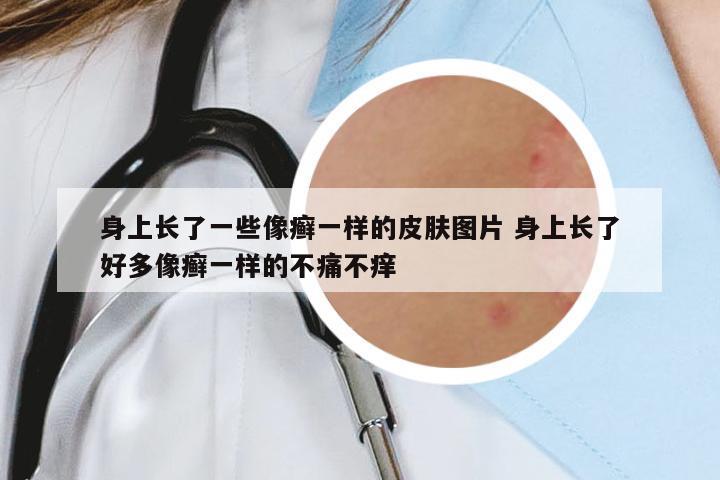 身上長了一些像癬一樣的皮膚圖片 身上長了好多像癬一樣的不痛不癢