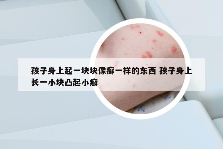 孩子身上起一塊塊像癬一樣的東西 孩子身上長一小塊凸起小癬