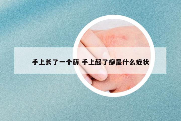 手上長了一個(gè)蘚 手上起了癬是什么癥狀