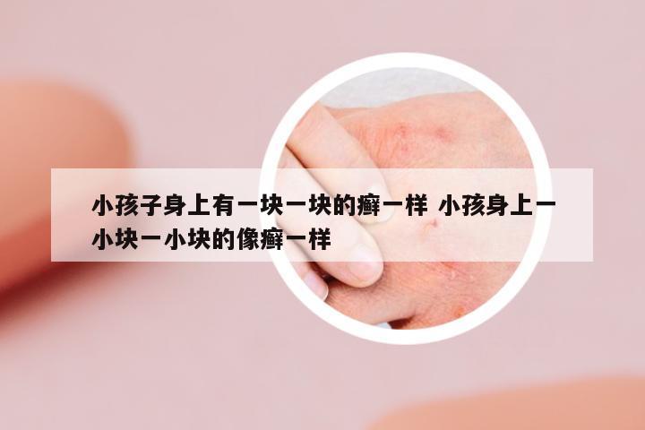 小孩子身上有一塊一塊的癬一樣 小孩身上一小塊一小塊的像癬一樣
