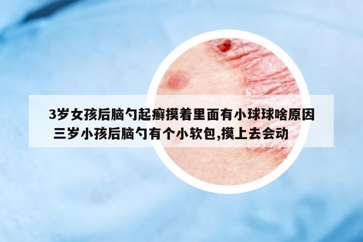 3歲女孩后腦勺起癬摸著里面有小球球啥原因 三歲小孩后腦勺有個(gè)小軟包,摸上去會(huì)動(dòng)