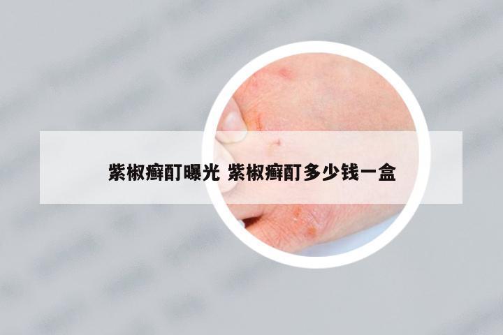 紫椒癬酊曝光 紫椒癬酊多少錢一盒