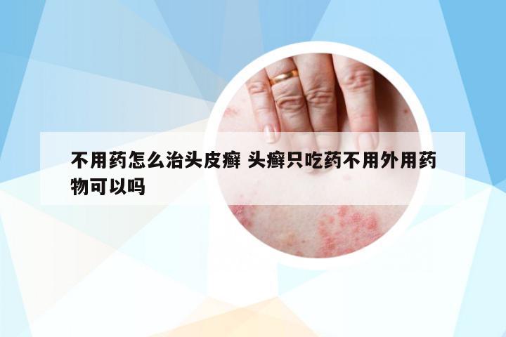 不用藥怎么治頭皮癬 頭癬只吃藥不用外用藥物可以嗎