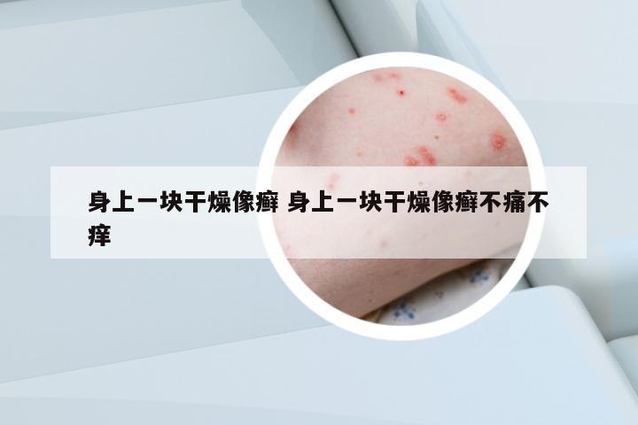 身上一塊干燥像癬 身上一塊干燥像癬不痛不癢