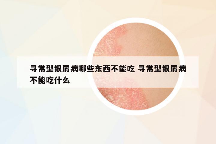 尋常型銀屑病哪些東西不能吃 尋常型銀屑病不能吃什么